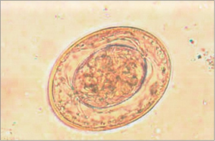  Hymanolepis nana egg