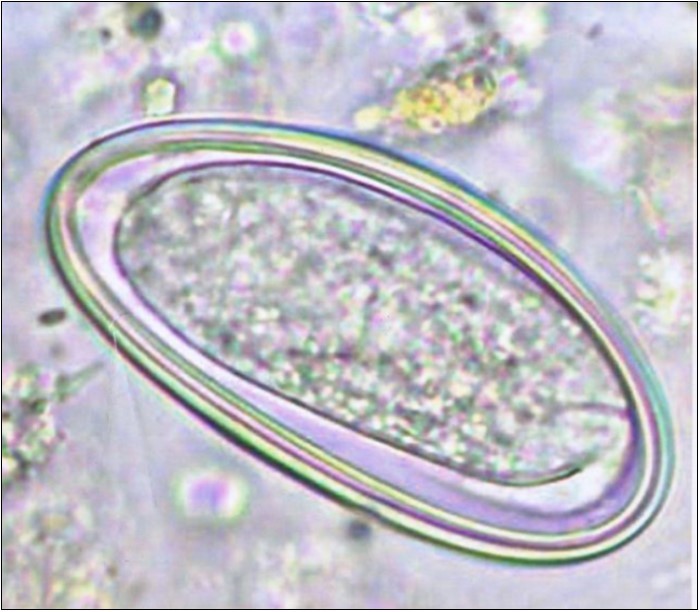  Enterobius vermicularis egg