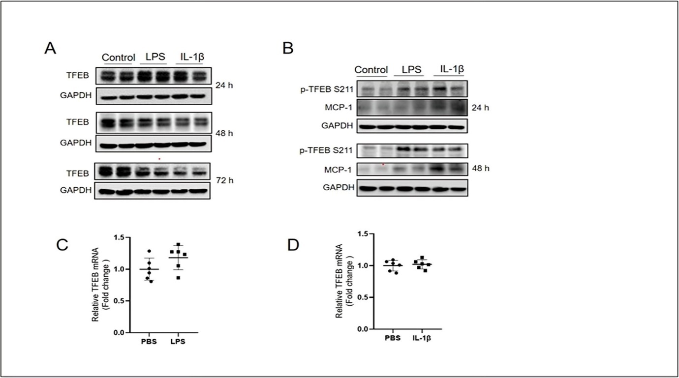Keratinocytes stimulated with proinflammatory mediators show a decreased TFEB activity. (A) Western blotting results showing the protein expression level of TFEB in HaCaT cells stimulated with LPS (10 μg/mL) and IL-1β (10 ng/mL) for 24, 48 and 72 h. (B) Western blotting results showing the protein expression level of p-TFEB S211 and MCP-1 in HaCaT cells stimulated with LPS (10 μg/mL) and IL-1β (10 ng/mL) for 24 and 48 h. (C) Quantitative PCR results showing the mRNA expression level of TFEB in HaCaT cells stimulated with LPS (10 μg/mL). (D) Quantitative PCR results showing the mRNA expression level of TFEB in HaCaT cells stimulated with IL-1β (10 ng/mL).