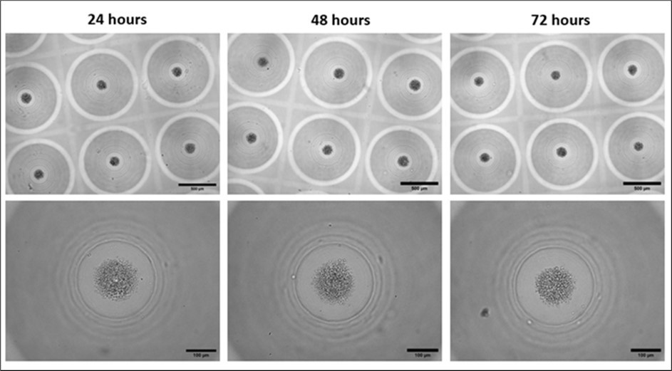 Morphology of PBMC aggregates in 3D CoSeedis™. Representative microscopic (brightfield) images showing the morphology of PBMCs aggregates (600 cpm) within the 3D CoSeedis™ chips at each respective time point (24, 48 and 72 hours) after cell seeding and at 2 different magnifications (5x and 20x). Scale bars: 500 µm (upper images) and 100 µm (lower images).