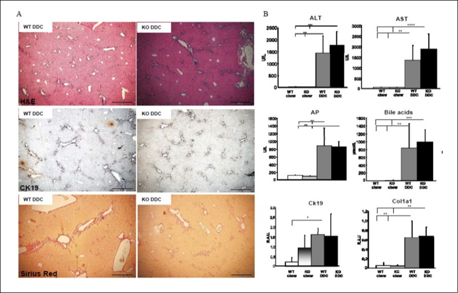 Figure 4. Pnpla3 deficiency does not affect biliary fibrosis or cholangitis in a DDC mouse model diet. A: H&E, CK19 and Sirius red staining showed similar bile duct injury and increased ductular reaction between WT and Pnpla3 KO. Fig4B: ALT, AST, AP and serum bile acid levels increased upon DDC feeding to the same degree in WT and Pnpla3 KO. CK19 gene expression increased significantly between WT-chow and WT-DDC fed mice but not in Pnpla3 KO. Col1a1 had similar gene induction in DDC-fed WT and KO (n=5).