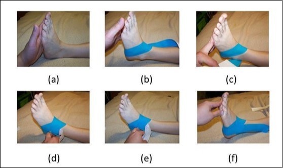 Star Excursion Balance Test (sebt): comparison of results with and ...