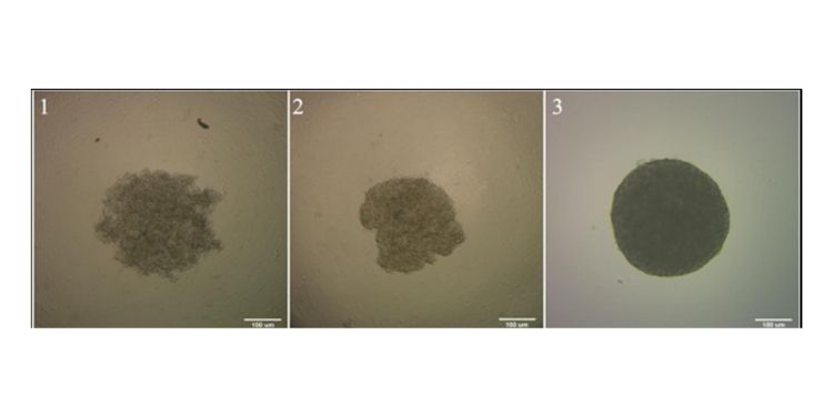 Journal of Hematalogy and Oncology Research-Spheroids